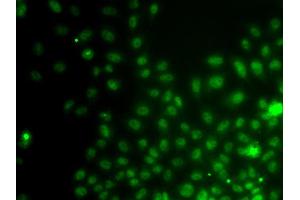Immunofluorescence analysis of A549 cell using IWS1 antibody. (IWS1 抗体)