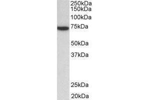 Western Blotting (WB) image for anti-zeta-Chain (TCR) Associated Protein Kinase 70kDa (ZAP70) (Internal Region) antibody (ABIN2465058) (ZAP70 抗体  (Internal Region))