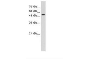 Image no. 2 for anti-Pre-mRNA Processing Factor 19 (PRPF19) (AA 151-200) antibody (ABIN203527) (PRP19 抗体  (AA 151-200))