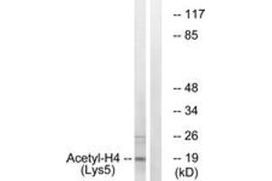 Western blot analysis of extracts from COS7 cells, treated with TSA 400nM 24h, using Histone H4 (Acetyl-Lys5) Antibody. (Histone H4 抗体  (acLys5))