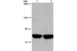 Western Blot analysis of Hela and PC3 cell using PFKP Polyclonal Antibody at dilution of 1:500 (PFKP 抗体)