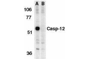 Western blot analysis of Caspase-12 in mouse brain tissue lysate in the absence (A) or presence (B) of blocking peptide with Caspase-12 antibody at 1μg/ml. (Caspase 12 抗体  (AA 100-116))