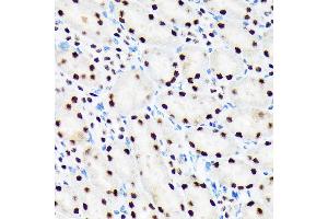 Immunohistochemistry of paraffin-embedded mouse kidney using PBRM1 Rabbit mAb (ABIN1512585, ABIN3020942, ABIN3020943 and ABIN7101308) at dilution of 1:100 (40x lens). (Polybromo 1 抗体)