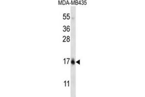 Western Blotting (WB) image for anti-HIST1H2BC,HIST1H2BF antibody (ABIN2996984) (HIST1H2BC,HIST1H2BF 抗体)