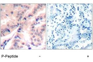 Image no. 1 for anti-Eukaryotic Translation Initiation Factor 4B (EIF4B) (pSer422) antibody (ABIN401564) (EIF4B 抗体  (pSer422))