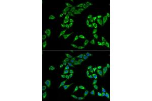 Immunofluorescence analysis of HeLa cells using PHLDA2 antibody (ABIN5973675). (PHLDA2 抗体)