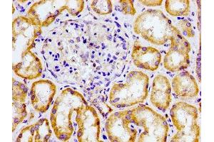 Immunohistochemistry of paraffin-embedded human kidney tissue using ABIN7147549 at dilution of 1:100 (CMKLR1 抗体  (AA 321-373))