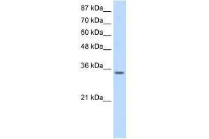 SNRPA antibody used at 0. (SNRPA1 抗体  (Middle Region))