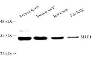 Western blot analysis of MLF1 (ABIN7074712) at dilution of 1: 500 (MLF1 抗体)