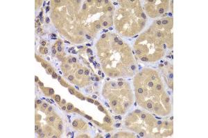 Immunohistochemistry of paraffin-embedded human kidney using BAG2 antibody at dilution of 1:100 (40x lens). (BAG2 抗体)