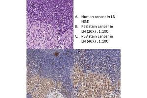 Immunohistochemistry of Goat Anti-p38 Antibody Immunohistochemistry of Goat Anti-p38 Antibody. (MAPK14 抗体)