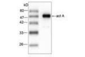 Image no. 1 for anti-Listeria Monocytogenes ActA (AA 117-278) antibody (ABIN791620) (Listeria Monocytogenes ActA (AA 117-278) 抗体)