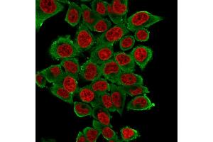 Immunofluorescence Analysis of HeLa cells labeling Smooth Muscle Actin with Smooth Muscle Actin Mouse Monoclonal Antibody (SPM322) followed by Goat anti-Mouse IgG-CF488(Green). (Smooth Muscle Actin 抗体  (N-Term))