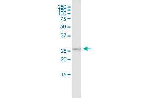 Immunoprecipitation of KIF26A transfected lysate using rabbit polyclonal anti-KIF26A and Protein A Magnetic Bead ( U0007 ), and immunoblotted with mouse purified polyclonal anti-KIF26A. (KIF26A (人) IP-WB Antibody Pair)