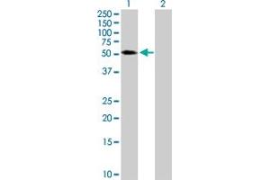 Western Blot analysis of TRIM65 expression in transfected 293T cell line by TRIM65 MaxPab polyclonal antibody. (TRIM65 抗体  (AA 1-517))