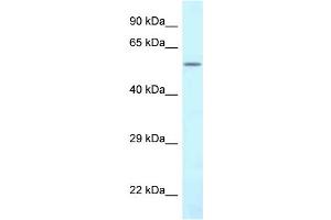 WB Suggested Anti-CTPS2 Antibody Titration: 1. (CTPS2 抗体  (N-Term))