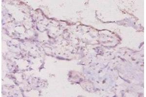 Immunohistochemistry of paraffin-embedded human placenta tissue using ABIN7177333 at dilution of 1:20 (Interferon gamma 抗体  (AA 27-155))