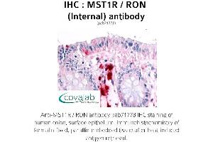 Image no. 1 for anti-Macrophage Stimulating 1 Receptor (C-Met-Related tyrosine Kinase) (MST1R) (Internal Region) antibody (ABIN1737097) (MST1R 抗体  (Internal Region))