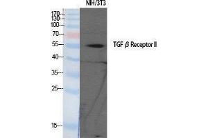 Western Blotting (WB) image for anti-Transforming Growth Factor, beta Receptor II (70/80kDa) (TGFBR2) (Tyr159) antibody (ABIN3177698) (TGFBR2 抗体  (Tyr159))