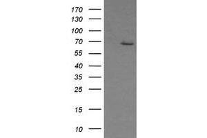 Image no. 2 for anti-Estrogen Receptor 1 (ESR1) antibody (ABIN1498061) (Estrogen Receptor alpha 抗体)