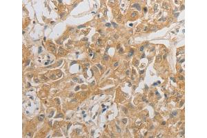 Immunohistochemistry (IHC) image for anti-Hypocretin (Orexin) Receptor 2 (HCRTR2) antibody (ABIN2431739) (HCRTR2 抗体)