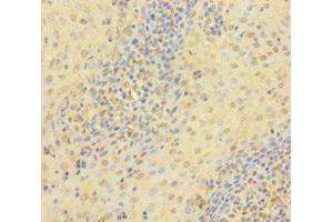 Immunohistochemistry of paraffin-embedded human tonsil tissue using ABIN7172118 at dilution of 1:100 (Thymidine Phosphorylase 抗体  (AA 13-254))