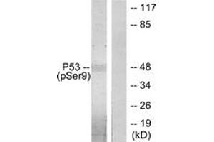 Western Blotting (WB) image for anti-Tumor Protein P53 (TP53) (pSer9) antibody (ABIN2888503) (p53 抗体  (pSer9))