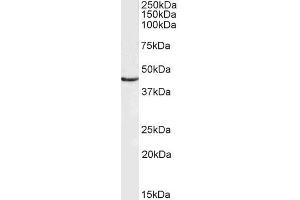 ABIN6391363 (0. (Doublecortin 抗体  (Internal Region))