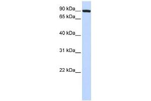 TFR2 antibody used at 1 ug/ml to detect target protein. (Transferrin Receptor 2 抗体  (N-Term))