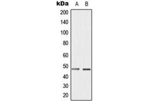 Western blot analysis of Cyclin E1 (pT395) expression in HepG2 (A), JAR (B) whole cell lysates. (Cyclin E1 抗体  (C-Term, pSer395))