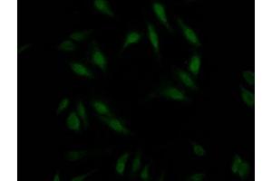 Immunofluorescence (IF) image for anti-Ring Finger Protein 2 (RNF2) antibody (ABIN7127796)