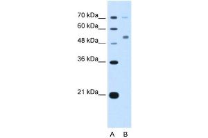 CDR2 antibody used at 5 ug/ml to detect target protein. (CDR2 抗体  (N-Term))