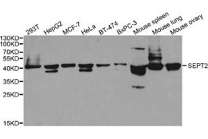 Western blot analysis of extracts of various cell lines, using SEPT2 antibody. (Septin 2 抗体)