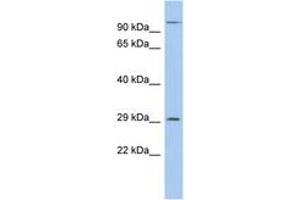 Image no. 1 for anti-Kv Channel Interacting Protein 2 (KCNIP2) (AA 35-84) antibody (ABIN6742555) (KCNIP2 抗体  (AA 35-84))