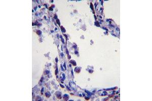 Immunohistochemistry (IHC) image for anti-Surfactant Protein C (SFTPC) antibody (ABIN2997467) (Surfactant Protein C 抗体)