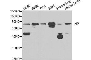 Western blot analysis of extracts of various cell lines, using HP antibody. (Haptoglobin 抗体)