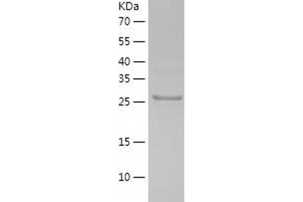 PDXP Protein (AA 1-292) (His tag)