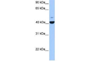 FGFR1OP antibody used at 1 ug/ml to detect target protein. (FGFR1OP 抗体  (N-Term))