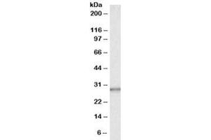 Western blot testing of human liver lysate with CA1 antibody at 0. (CA1 抗体)