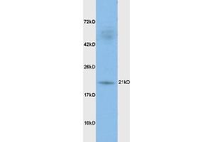 Rat brain lysates probed with Anti DHFR Polyclonal Antibody, Unconjugated (ABIN1387277) at 1:200 in 4 °C. (Dihydrofolate Reductase 抗体)