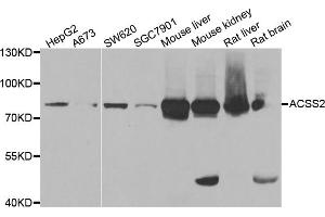 Western blot analysis of extracts of various cell lines, using ACSS2 antibody (ABIN5973869) at 1/1000 dilution. (ACSS2 抗体)