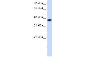 GLT8D2 抗体  (C-Term)