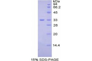 SDS-PAGE analysis of Human Ceruloplasmin Protein. (Ceruloplasmin 蛋白)