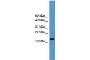 Image no. 1 for anti-Caspase 1 (CASP1) (AA 30-79) antibody (ABIN6745426) (Caspase 1 抗体  (AA 30-79))