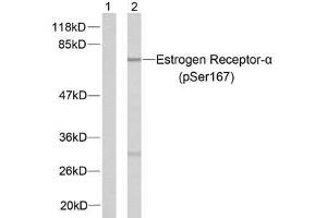 Western blot analysis of extracts from MCF7 cells using Estrogen Receptor-α (phospho-Ser167) antibody (E011073). (Estrogen Receptor alpha 抗体  (pSer167))