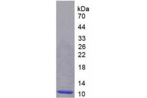 SDS-PAGE (SDS) image for Chemokine (C-X-C Motif) Ligand 2 (CXCL2) (AA 34-107) protein (His tag) (ABIN1170594) (CXCL2 Protein (AA 34-107) (His tag))