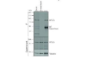 Immunoprecipitation analysis using Mouse Anti-VPS35 Monoclonal Antibody, Clone 5A9 (ABIN6932953). (VPS35 抗体  (PerCP))