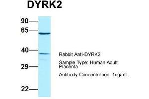 Host: Rabbit  Target Name: DYRK2  Sample Tissue: Human Adult Placenta  Antibody Dilution: 1. (DYRK2 抗体  (C-Term))