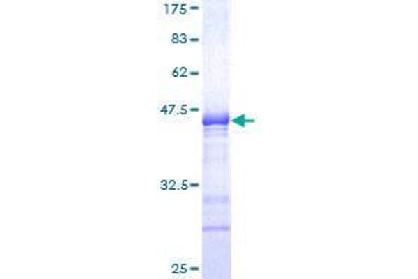 SOX6 Protein (AA 1-109) (GST tag)