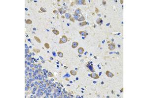 Immunohistochemistry of paraffin-embedded rat brain using GALNT2 Antibody (ABIN5974158) at dilution of 1/100 (40x lens). (GALNT2 抗体)